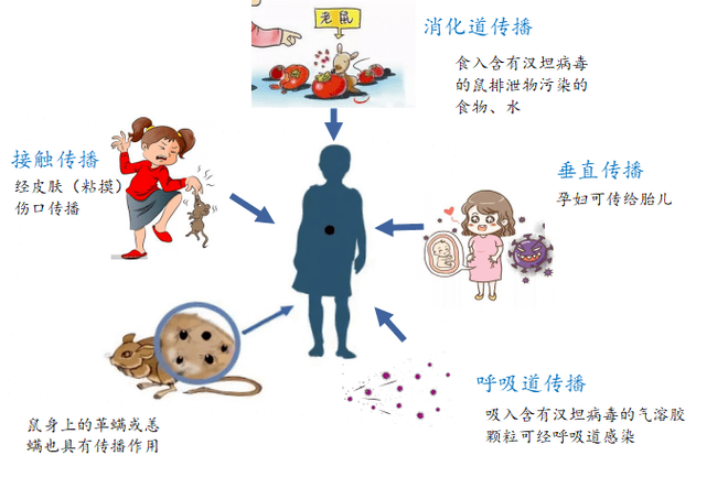 感染源包括哪些缩略图