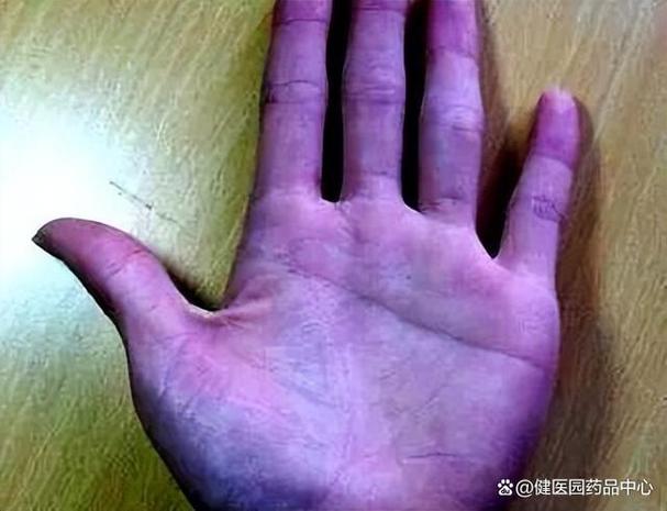 手掌紫色截图