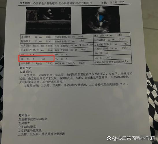 心功能ef65%,fs35%截图