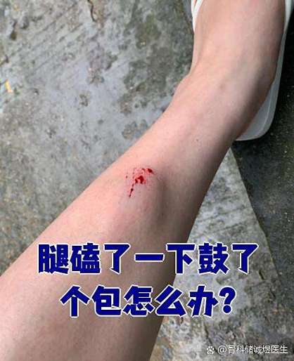 腿被踢了一脚一按就疼游戏截图
