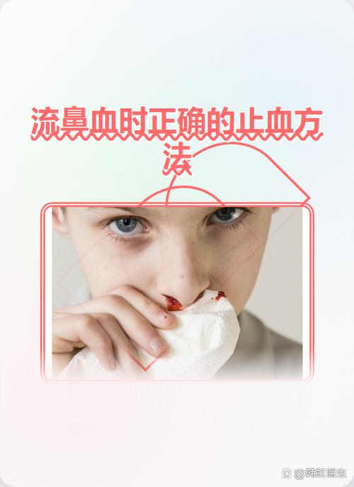 为啥擤鼻涕会流鼻血图标