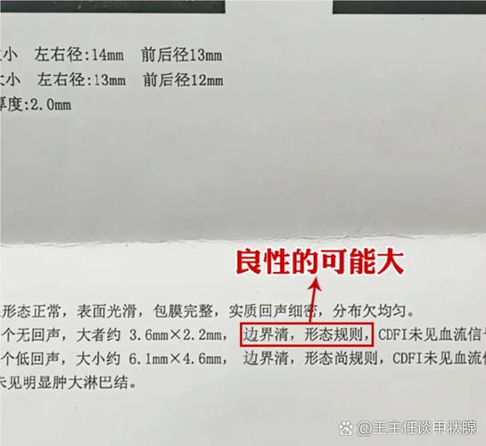 强回声是良性还是恶性截图