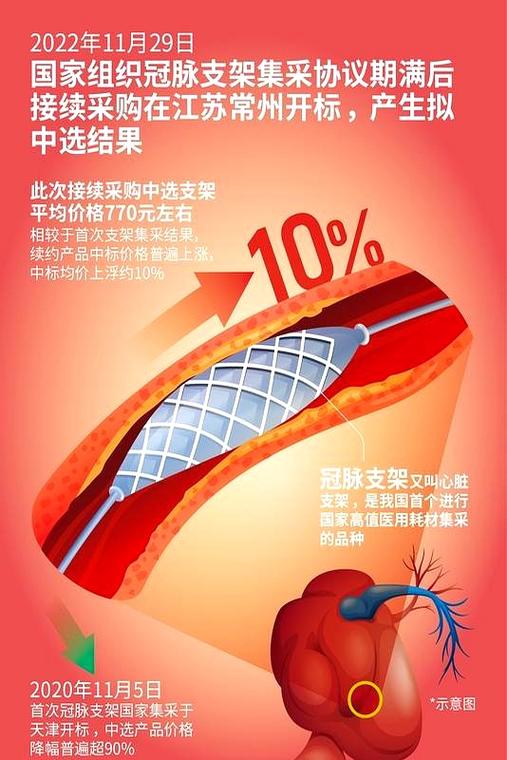 心血管支架最长寿命多少年缩略图