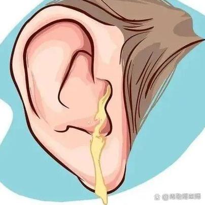 中耳炎拖久了会聋吗截图