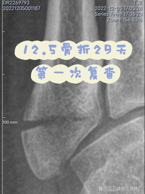移植第二十九天有暗区截图