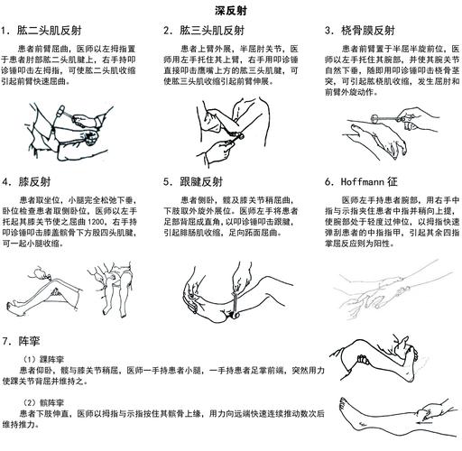 深反射和浅反射的区别截图