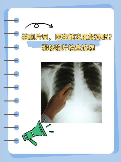 100胸片曝光率软件加速永久截图