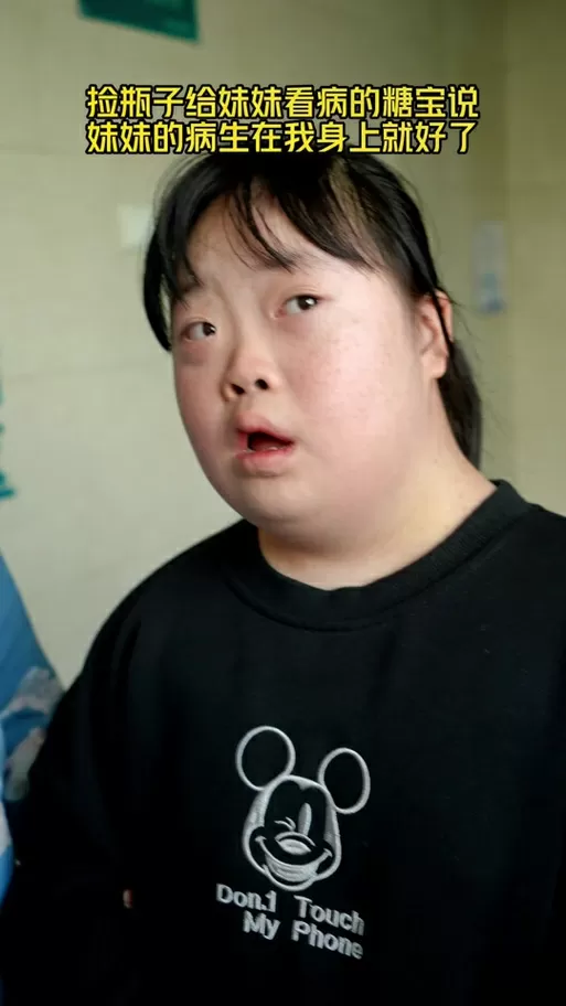 唐氏综合征为什么叫糖宝图标