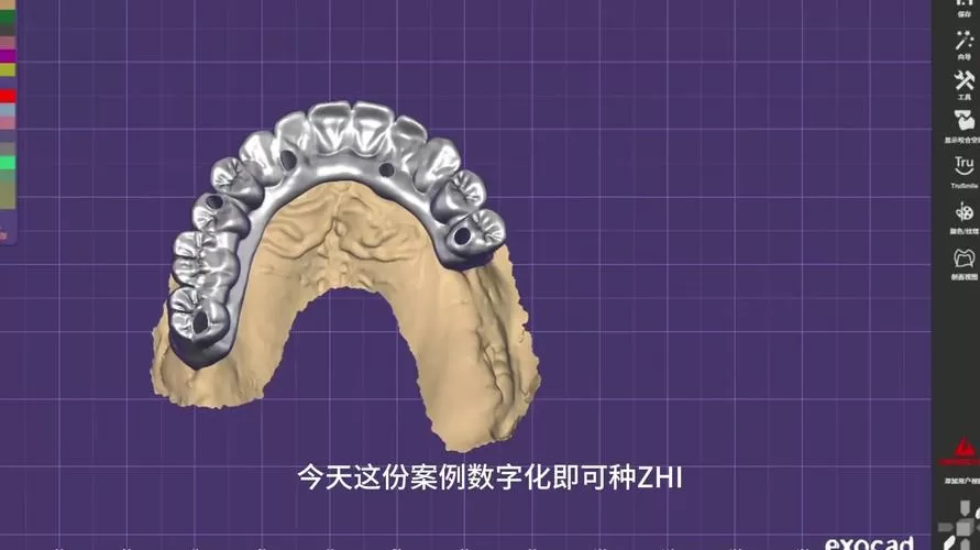 bitc数字化种植PPT截图